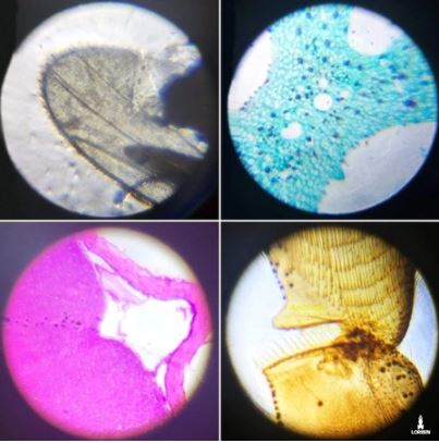 Kit Microscópio Infantil Lorben